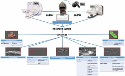 General Anesthesia: A Probe to Explore Consciousness